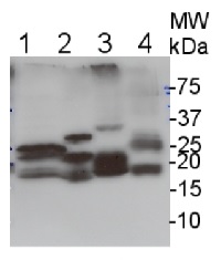 Lhc1 | from PSI of red alga in the group Antibodies for Plant/Algal  / Photosynthesis  / LHC at Agrisera AB (Antibodies for research) (AS08 282)